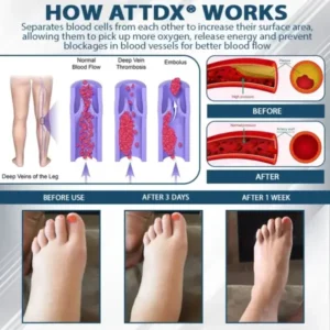 ATTDX® Llimpki® Black Cumin Edema Detox Herbal Cream
