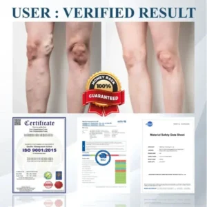 Llimpki® Black Cumin Edema Detox Herbal Cream